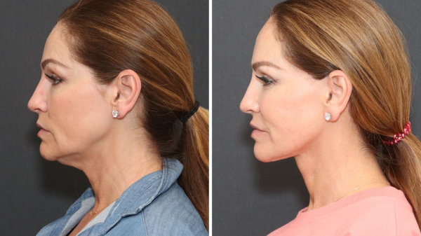 Image may contain Head Person Face Adult Hair Ponytail Accessories Earring Jewelry Clothing Jeans and Pants